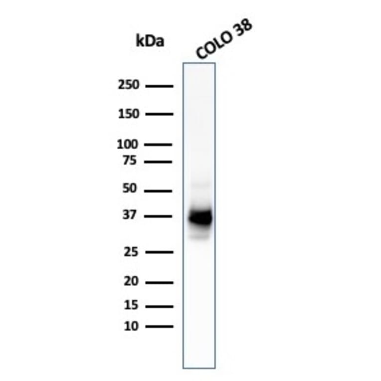 Western Blot - Anti-Melanoma gp100 Antibody [HMB45 + PMEL/783] (A249972) - Antibodies.com