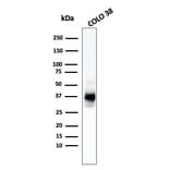 Western Blot - Anti-Melanoma gp100 Antibody [HMB45 + PMEL/783] (A249972) - Antibodies.com