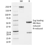 SDS-PAGE - Anti-Melanoma gp100 Antibody [PMEL/2037] (A249973) - Antibodies.com