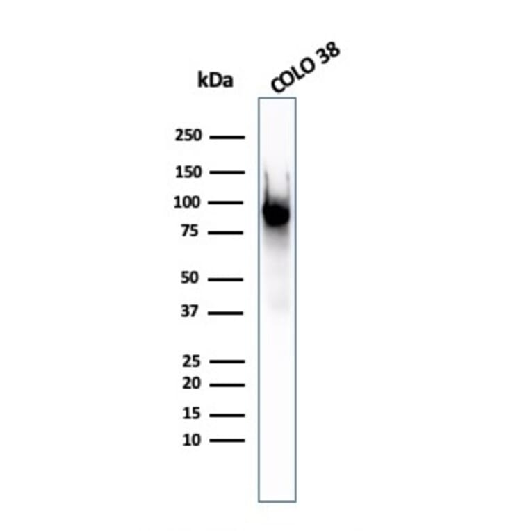 Western Blot - Anti-Melanoma gp100 Antibody [PMEL/2037] (A249973) - Antibodies.com