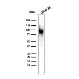 Western Blot - Anti-Melanoma gp100 Antibody [PMEL/2037] (A249973) - Antibodies.com