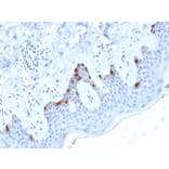 Immunohistochemistry - Anti-Melanoma gp100 Antibody [PMEL/2038] (A249974) - Antibodies.com