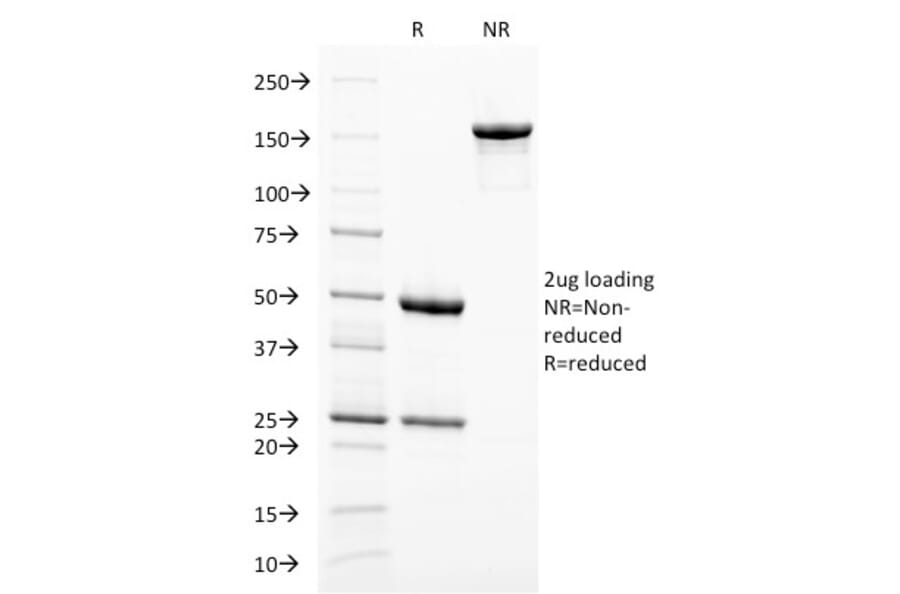 SDS-PAGE - Anti-Melanoma gp100 Antibody [PMEL/2038] (A249974) - Antibodies.com