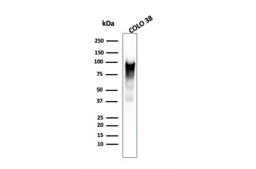 Western Blot - Anti-Melanoma gp100 Antibody [PMEL/2038] (A249974) - Antibodies.com