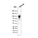 Western Blot - Anti-Melanoma gp100 Antibody [PMEL/2039] (A249975) - Antibodies.com