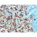 Immunohistochemistry - Anti-Melanoma gp100 Antibody [PMEL/1825R] (A249975) - Antibodies.com