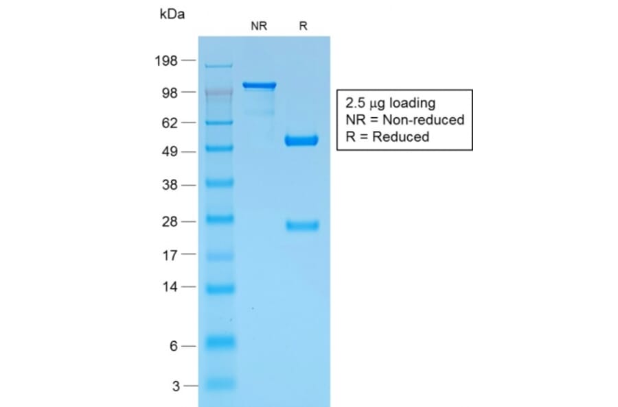 SDS-PAGE - Anti-Melanoma gp100 Antibody [PMEL/1825R] (A249976) - Antibodies.com