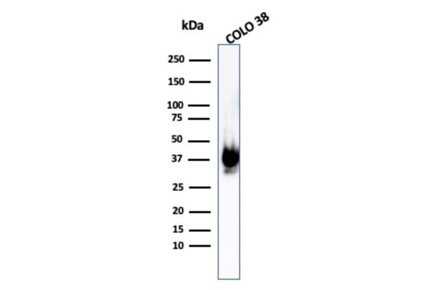 Western Blot - Anti-Melanoma gp100 Antibody [PMEL/1825R] (A249976) - Antibodies.com