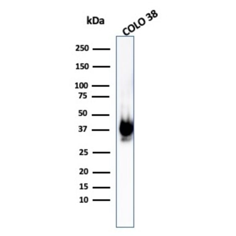 Western Blot - Anti-Melanoma gp100 Antibody [PMEL/1825R] (A249976) - Antibodies.com