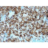 Immunohistochemistry - Anti-Melanoma gp100 Antibody (A249976) - Antibodies.com