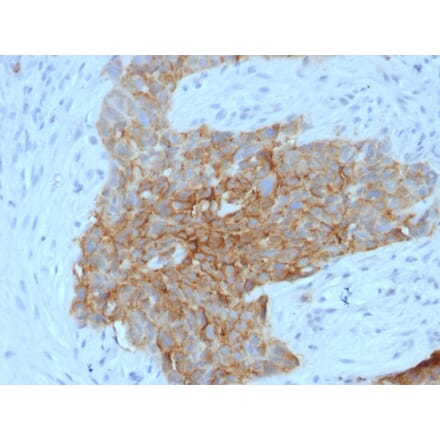 Immunohistochemistry - Anti-GLUT1 Antibody [GLUT1/2475] (A249978) - Antibodies.com
