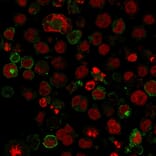 Immunofluorescence - Anti-GLUT1 Antibody [GLUT1/2475] (A249978) - Antibodies.com