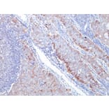 Immunohistochemistry - Anti-GLUT1 Antibody [GLUT1/2476] (A249979) - Antibodies.com