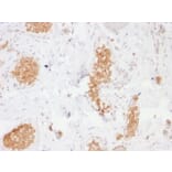Immunohistochemistry - Anti-GLUT1 Antibody [GLUT1/2476] (A249979) - Antibodies.com