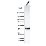 Western Blot - Anti-GLUT1 Antibody [GLUT1/2476] (A249979) - Antibodies.com