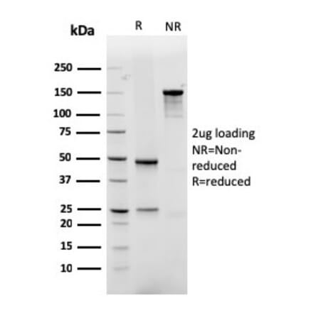 SDS-PAGE - Anti-GLUT1 Antibody [rGLUT1/2476] (A249980) - Antibodies.com
