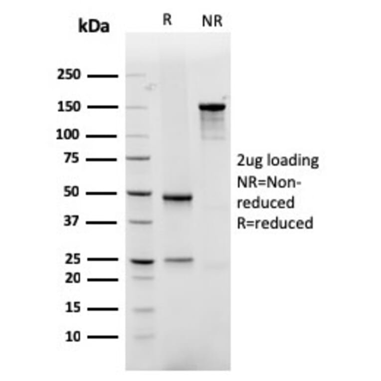 SDS-PAGE - Anti-GLUT1 Antibody [rGLUT1/2476] (A249980) - Antibodies.com