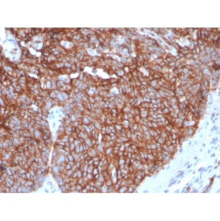 Immunohistochemistry - Anti-GLUT1 Antibody [GLUT1/3132R] (A249981) - Antibodies.com