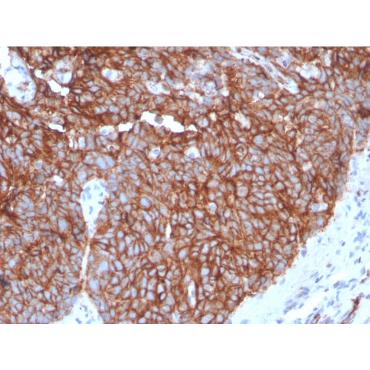 Immunohistochemistry - Anti-GLUT1 Antibody [GLUT1/3132R] (A249981) - Antibodies.com