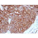 Immunohistochemistry - Anti-GLUT1 Antibody [GLUT1/3132R] (A249981) - Antibodies.com