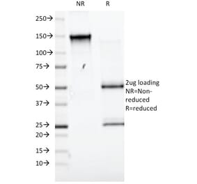 SDS-PAGE - Anti-CD98 Antibody [UM7F8] (A249981) - Antibodies.com