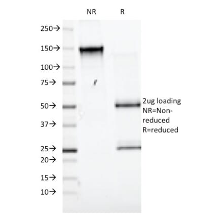 SDS-PAGE - Anti-CD98 Antibody [UM7F8] (A249981) - Antibodies.com