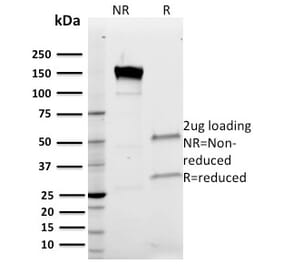 SDS-PAGE - Anti-Band 3 Antibody [Q1/156] (A249982) - Antibodies.com