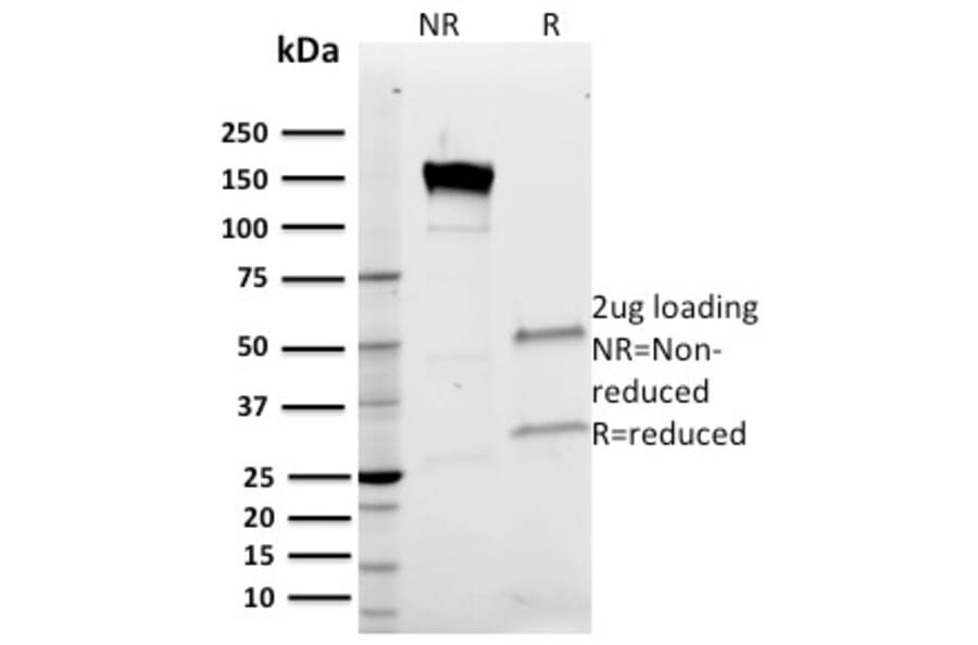SDS-PAGE - Anti-Band 3 Antibody [Q1/156] (A249982) - Antibodies.com