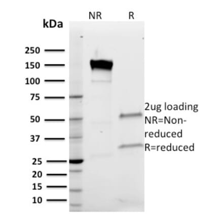 SDS-PAGE - Anti-Band 3 Antibody [Q1/156] (A249982) - Antibodies.com