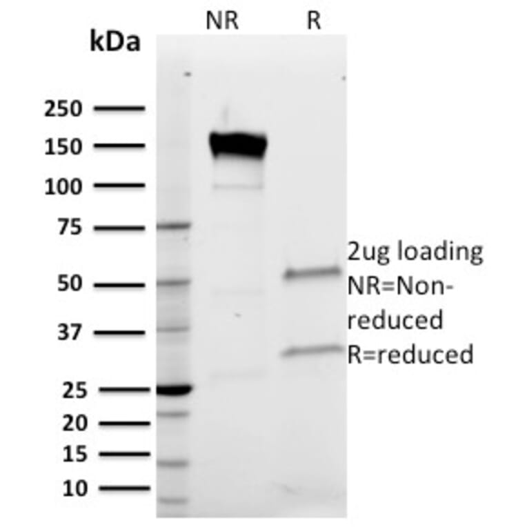 SDS-PAGE - Anti-Band 3 Antibody [Q1/156] (A249982) - Antibodies.com