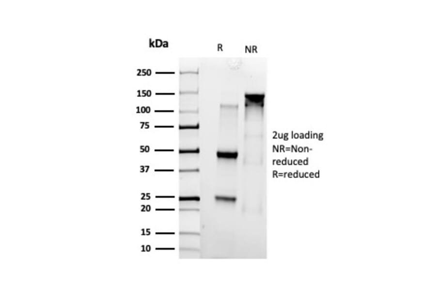 SDS-PAGE - Anti-SMARCC1 Antibody [PCRP-SMARCC1-1F1] (A249984) - Antibodies.com