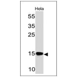 Western Blot - Anti-SUMO-2 + SUMO-3 Antibody [SM23/496] (A249985) - Antibodies.com