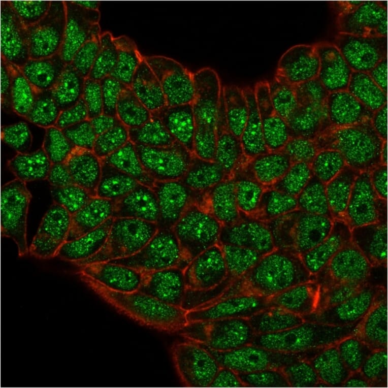 Immunofluorescence - Anti-SUMO-2 + SUMO-3 Antibody [SM23/496] (A249985) - Antibodies.com