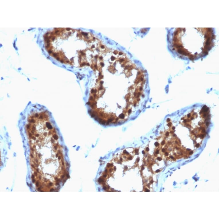 Immunohistochemistry - Anti-SUMO-2 + SUMO-3 Antibody [SPM572] (A249986) - Antibodies.com