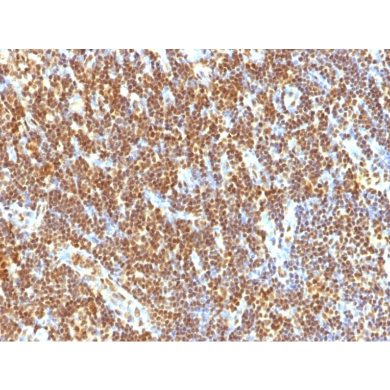 Immunohistochemistry - Anti-SUMO-2 Antibody [SUMO2/1199] (A249987) - Antibodies.com