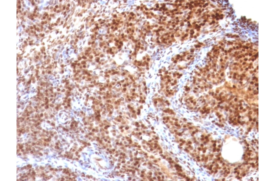 Immunohistochemistry - Anti-SUMO-2 Antibody [SUMO2/1199] (A249987) - Antibodies.com