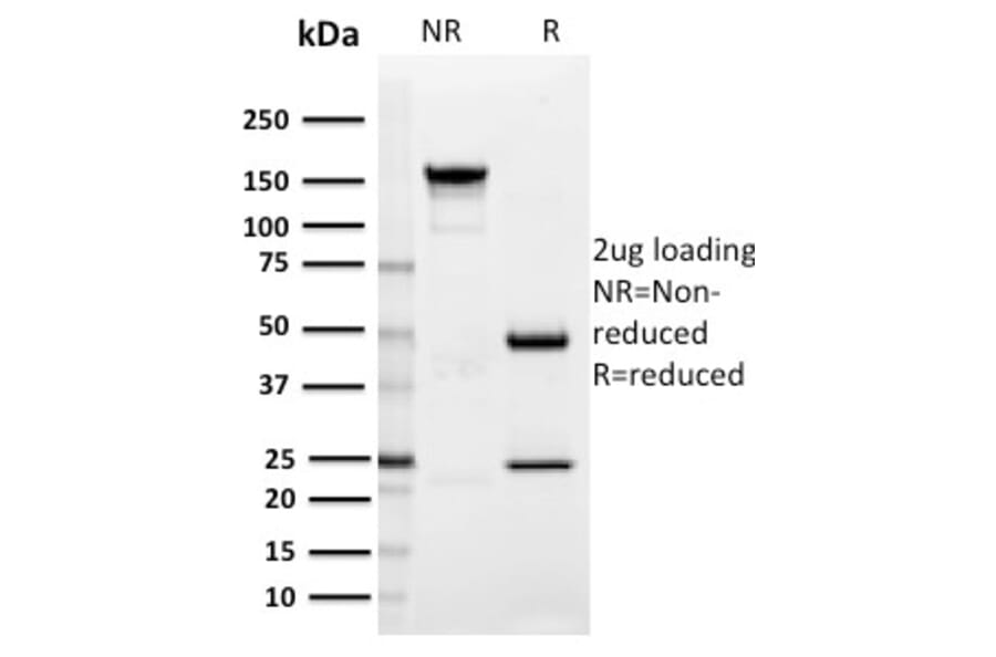 SDS-PAGE - Anti-SIGLEC1 Antibody [HSn 7D2] (A249988) - Antibodies.com