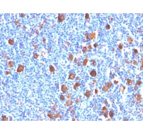 Immunohistochemistry - Anti-Fascin Antibody [FSCN1/416] (A249990) - Antibodies.com