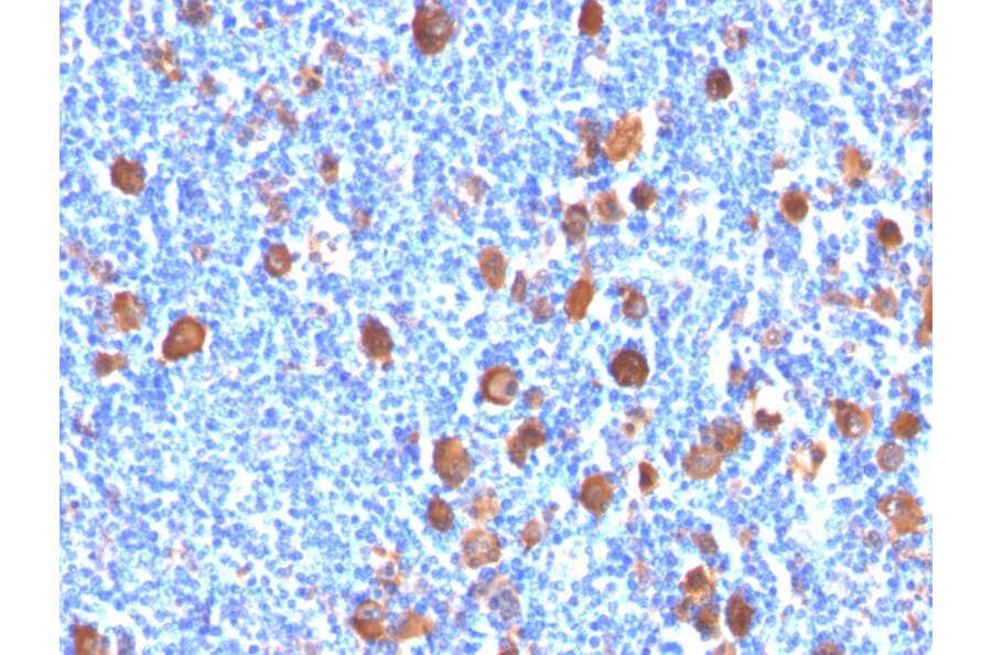 Immunohistochemistry - Anti-Fascin Antibody [FSCN1/416] (A249990) - Antibodies.com