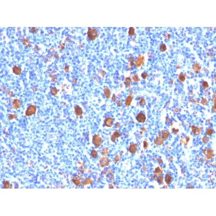 Immunohistochemistry - Anti-Fascin Antibody [FSCN1/416] (A249990) - Antibodies.com