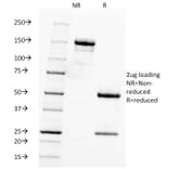 SDS-PAGE - Anti-Fascin Antibody [FSCN1/416] (A249990) - Antibodies.com