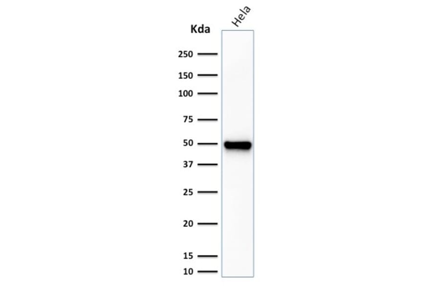 Western Blot - Anti-Fascin Antibody [FSCN1/416] (A249990) - Antibodies.com
