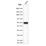 Western Blot - Anti-Fascin Antibody [FSCN1/416] (A249990) - Antibodies.com