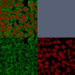 Immunofluorescence - Anti-Fascin Antibody [FSCN1/416] (A249990) - Antibodies.com
