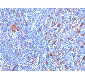 Immunohistochemistry - Anti-Fascin Antibody [FSCN1/417] (A249991) - Antibodies.com
