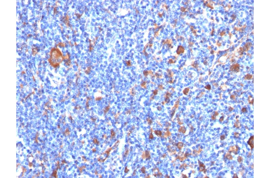 Immunohistochemistry - Anti-Fascin Antibody [FSCN1/417] (A249991) - Antibodies.com