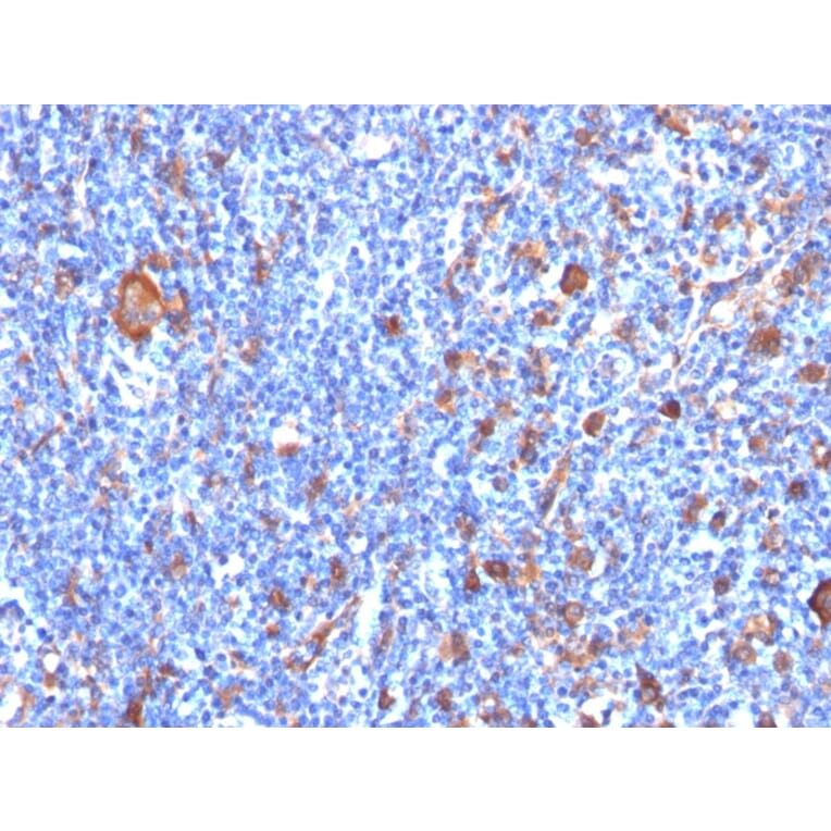 Immunohistochemistry - Anti-Fascin Antibody [FSCN1/417] (A249991) - Antibodies.com