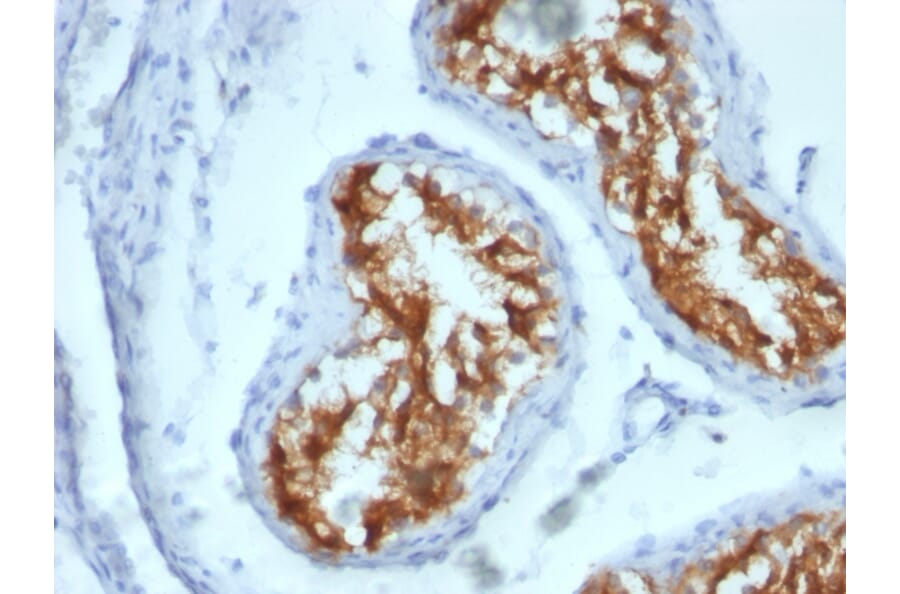 Immunohistochemistry - Anti-Fascin Antibody [FSCN1/417] (A249991) - Antibodies.com