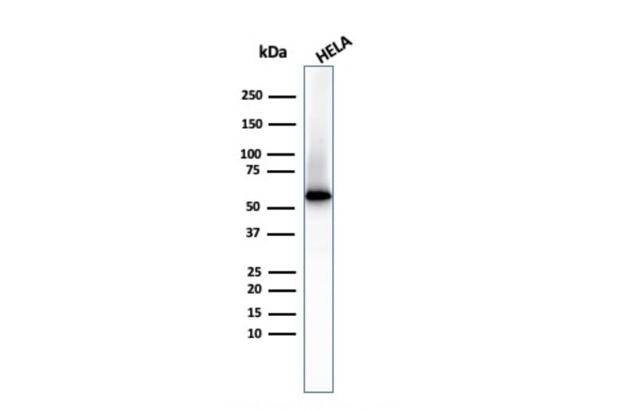 Western Blot - Anti-Fascin Antibody [FSCN1/417] (A249991) - Antibodies.com
