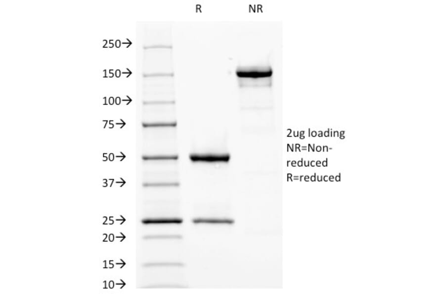 SDS-PAGE - Anti-Fascin Antibody [FSCN1/417] (A249991) - Antibodies.com